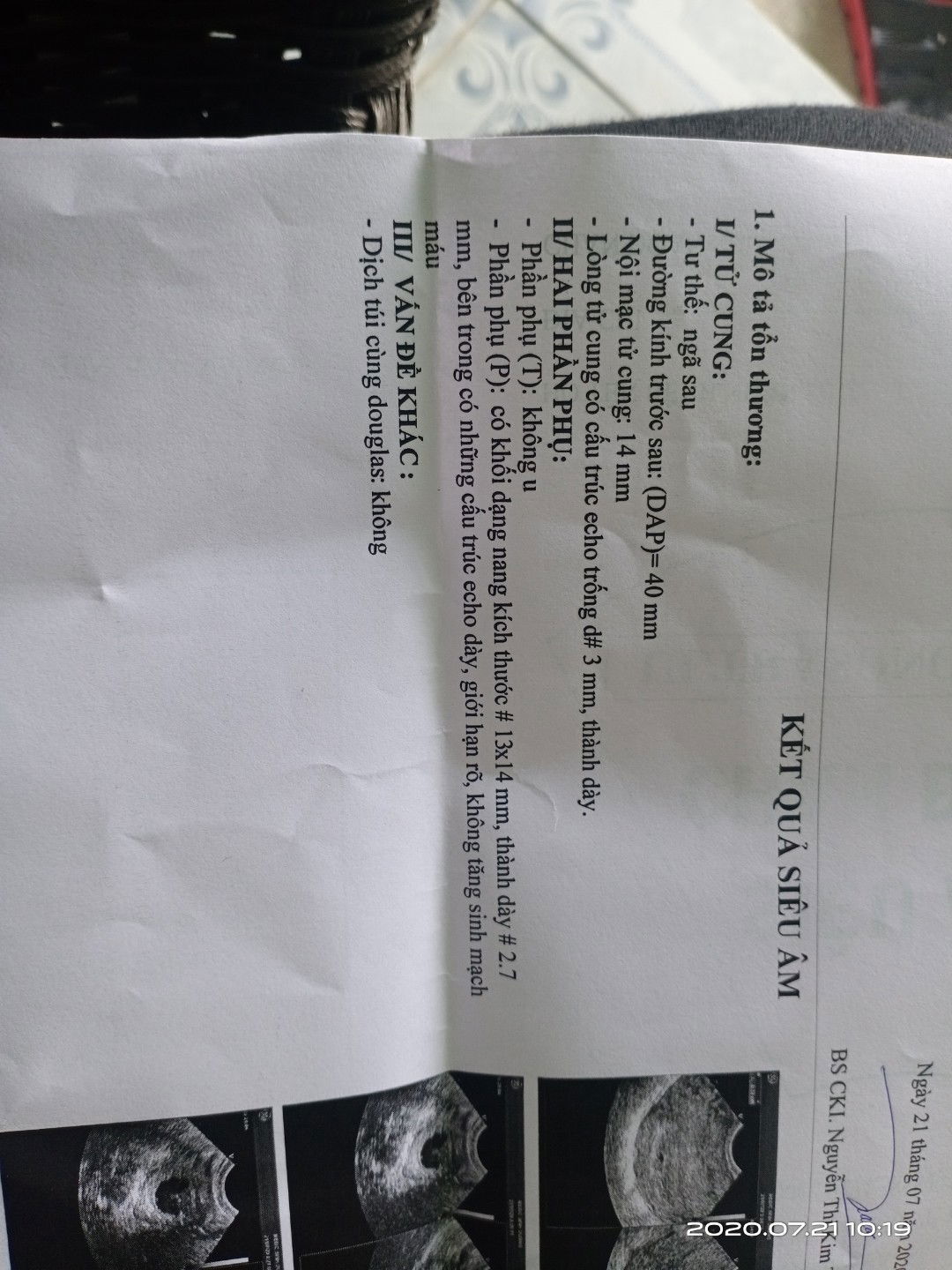 U nang khi mang thai