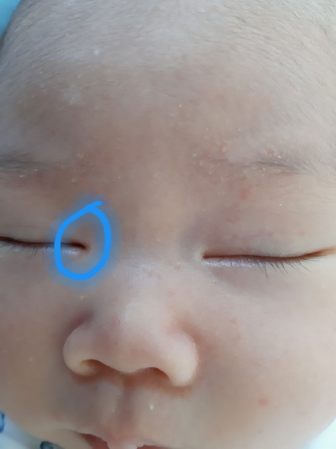 หัวตาน้องรู้สึกว่าจะเป็นรู