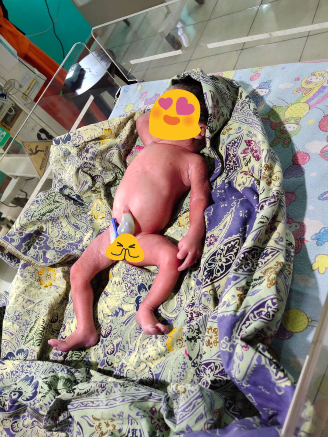 lahir prematur ditanggal yg cantik 02-02-2020