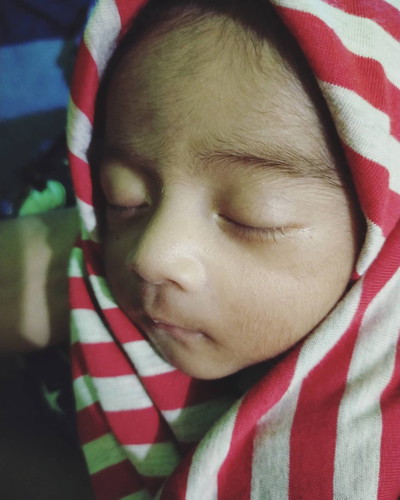 Perjuangan bayi prematur