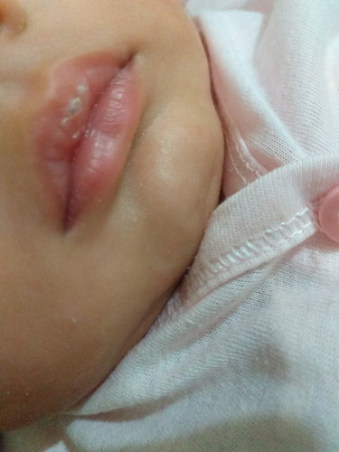 bibir bayi