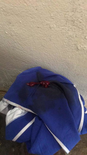 Medjo sensitive photo.