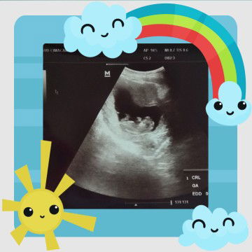 Ridatillah Alsyahna profile icon