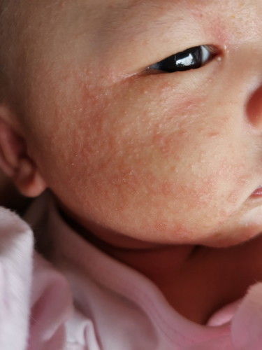 Ano Pong Gagawin Ko Dto Para Mawala