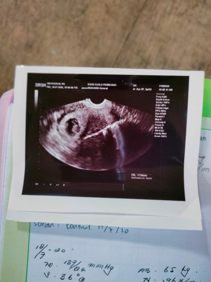 sri rozalia profile icon