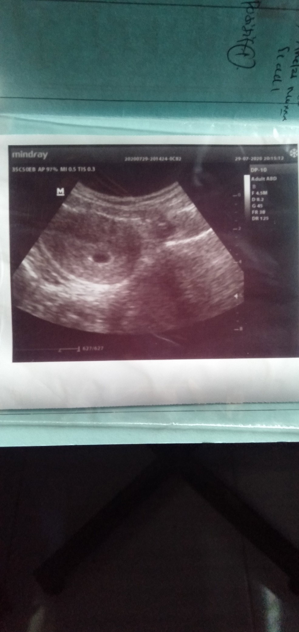 USG WEEK 6 DI KATAKAN KEMBAR