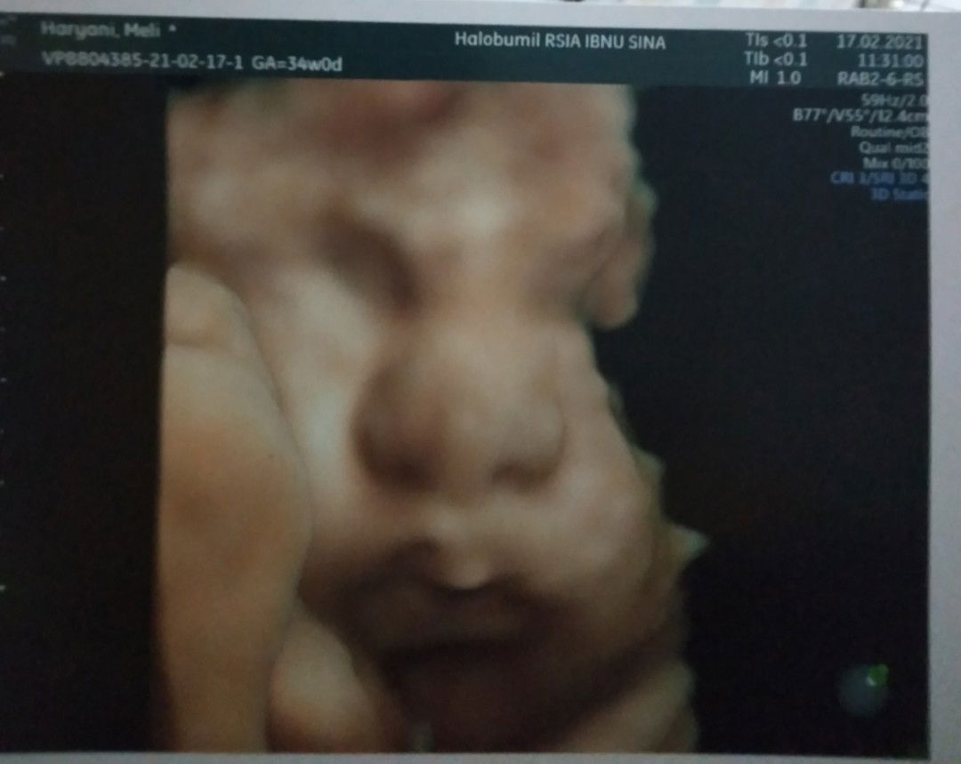 Meli Heryani profile icon