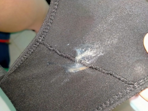 แบบนี้ใช่มูกเลือกหรือป่าวคะ