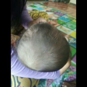 ลูกหัวเเบน