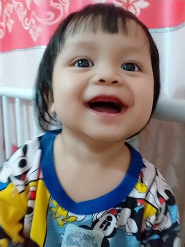 1ขวบแล้วแต่ฟันขึ้นซี่เดียวค่ะเพื่อนๆน้องๆขึ้นกี่ซี่กันคะ?