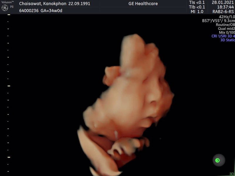 Kanokphan.C profile icon