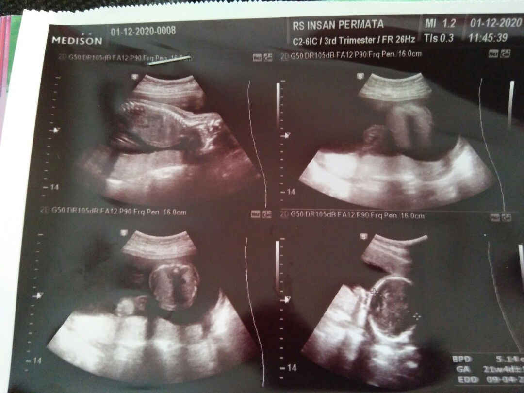 Mia Puspita Evawani profile icon