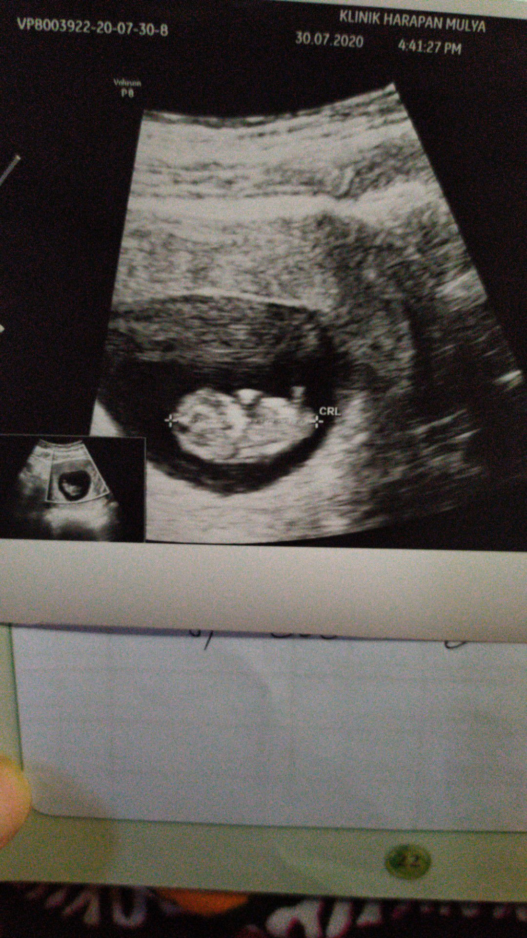 Aprilia Rahma profile icon