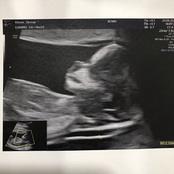 Sirorat Ritnok profile icon