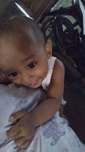 kurang prtumbuhan rambut