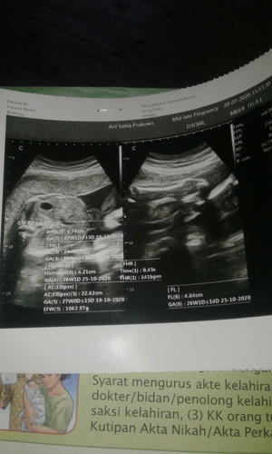 mengenai jnis kelamin janin