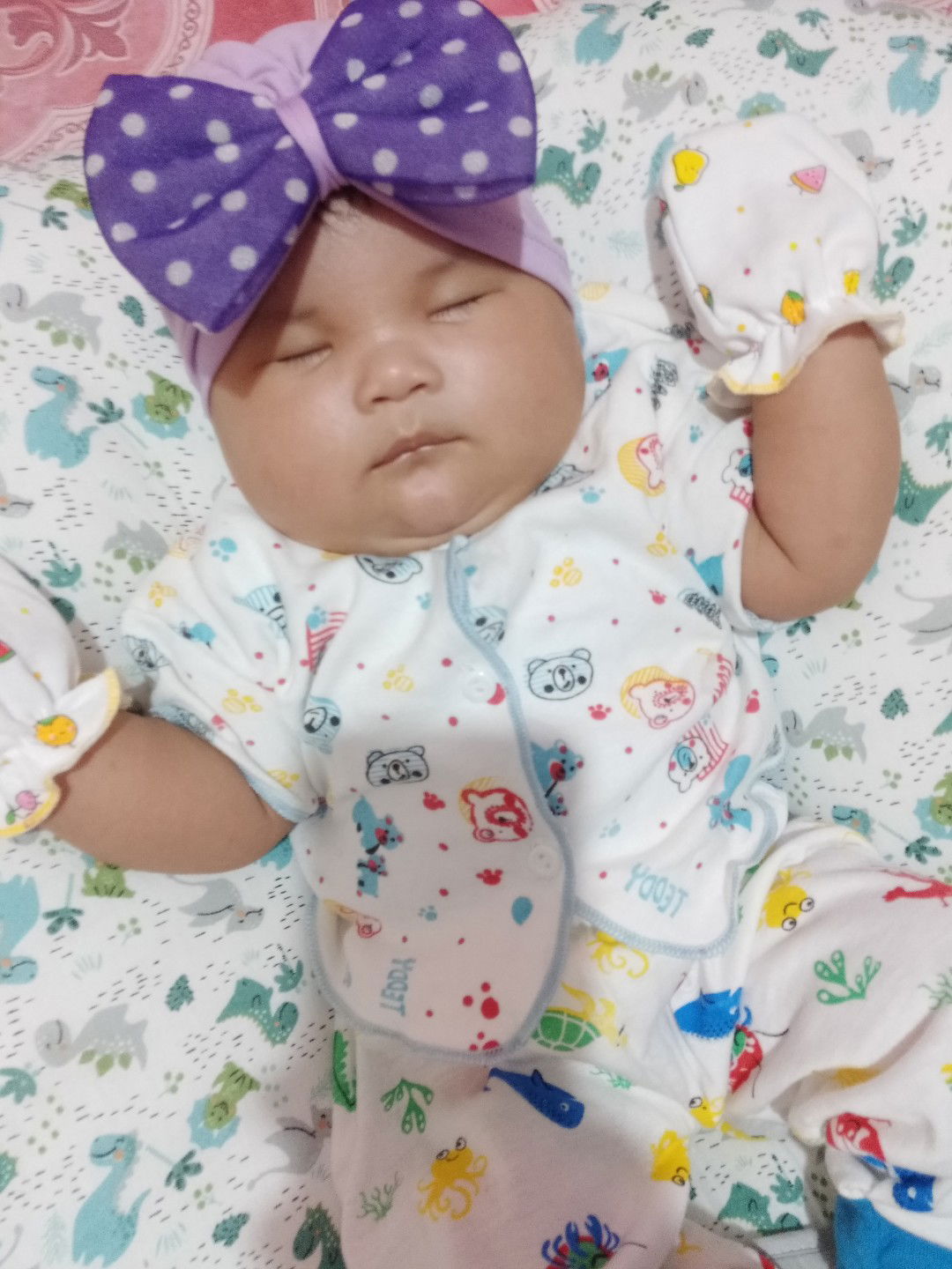 Perut bayi kembung