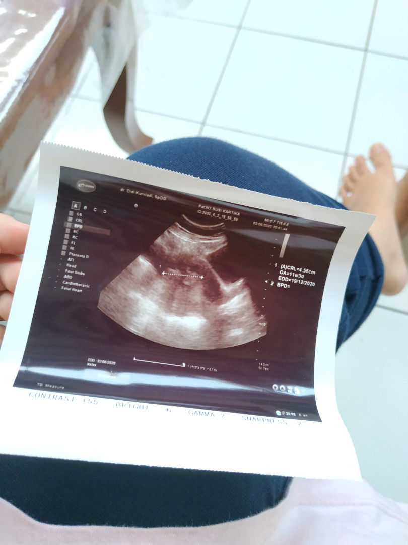 Susi Kartika profile icon