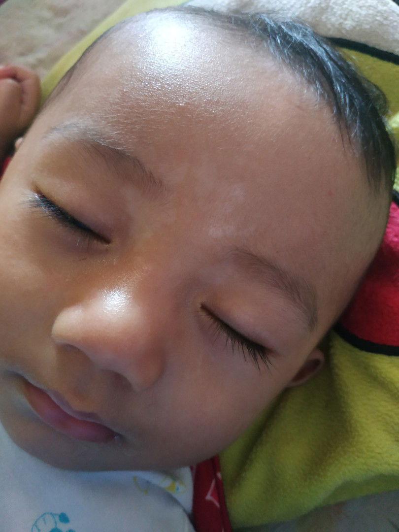 Apakah ini karna bekas asi?