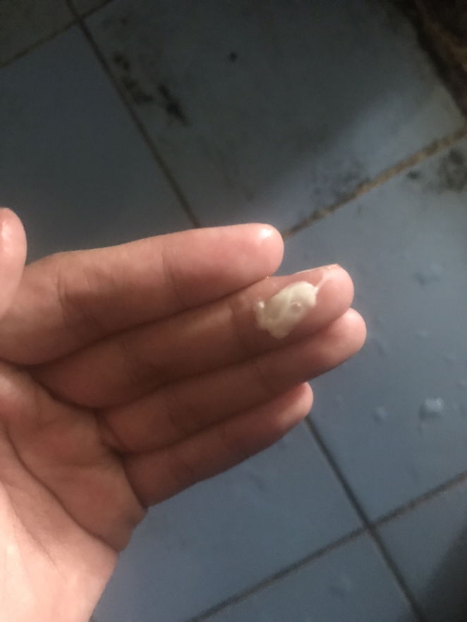 Keputihan atau mucus plug?