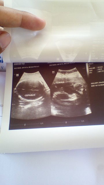 Juvelyn Cervantes Bato profile icon