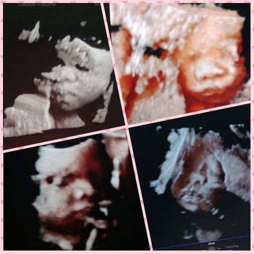 Anna Banana profile icon