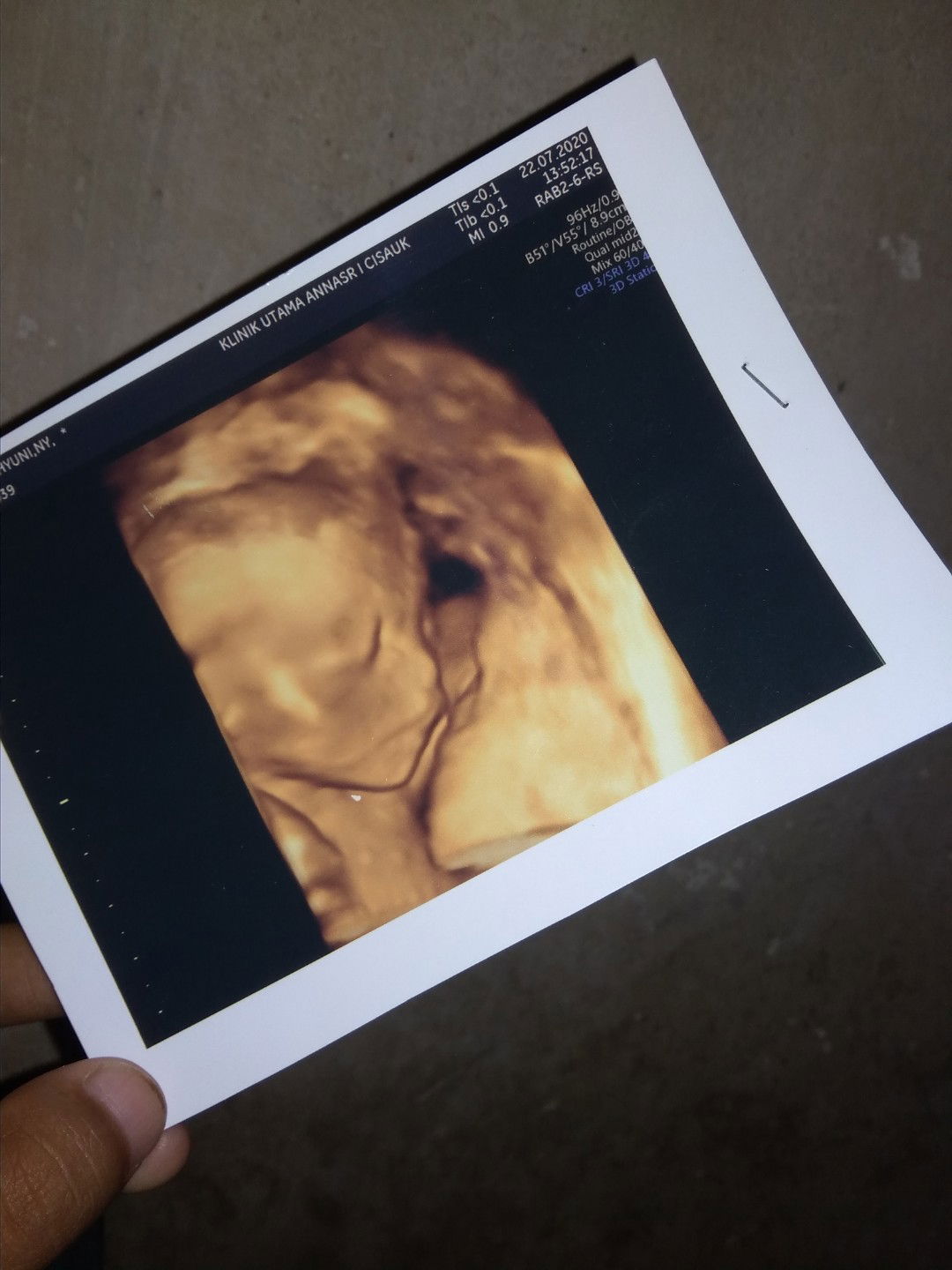 Tri Sandra Mulyawan profile icon