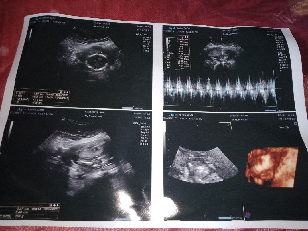 nurcahyani profile icon