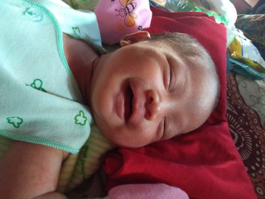 bayi senyum saat tdr