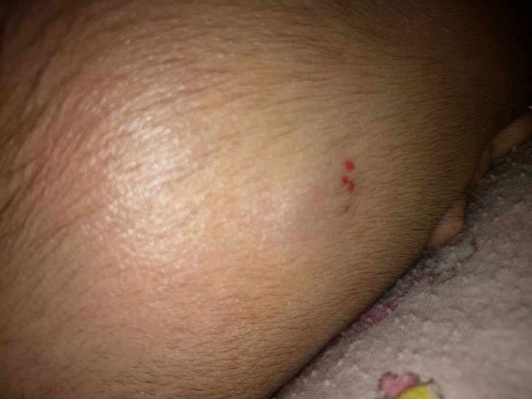 ada benjolan dikepala bayi saya tp tdk sakit itu kenapa ya bun