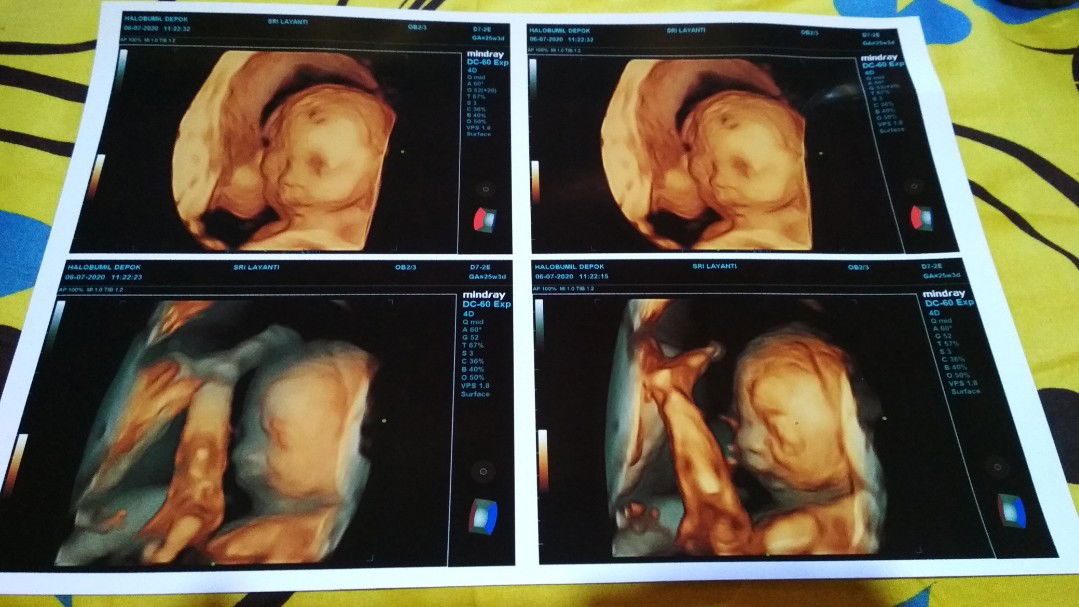 Sri Layanti profile icon