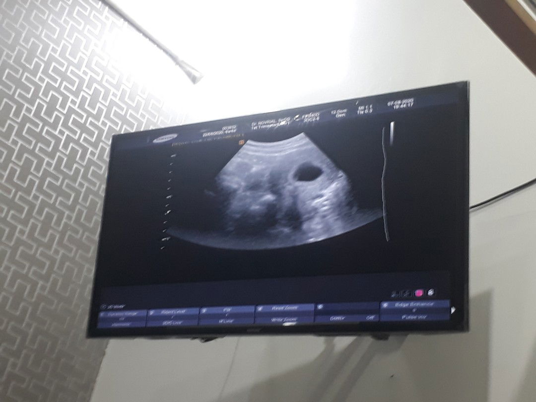 Romini Br. Tambunan profile icon