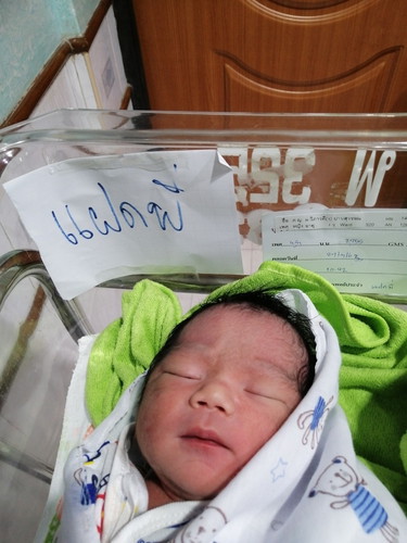 น้องแฝด