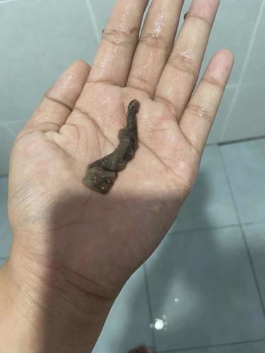 แบบนี้คืออะไรคะ? ท้องแรกค่ะ