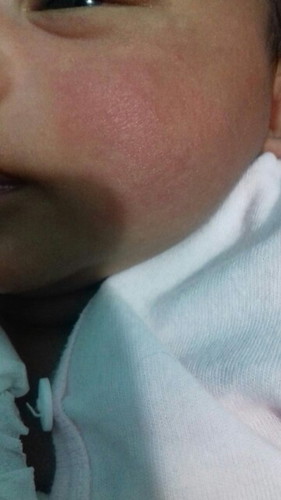 pipi bayi ku merah