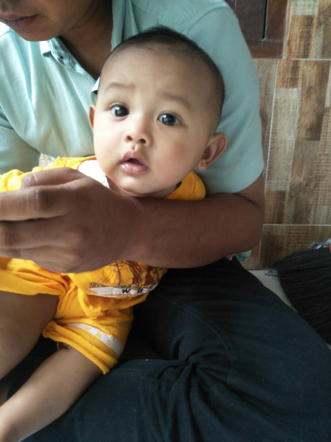 apakah anakku downsyndrom????????