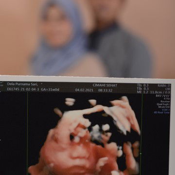 Della Purnamasari II profile icon