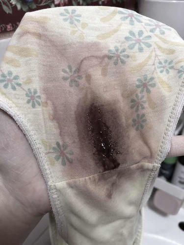 39weeks pregnant. Normal po ba?