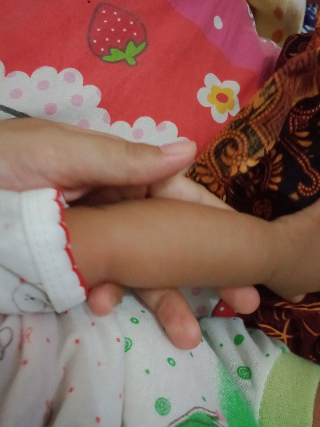 Merah" pd kulit bayi