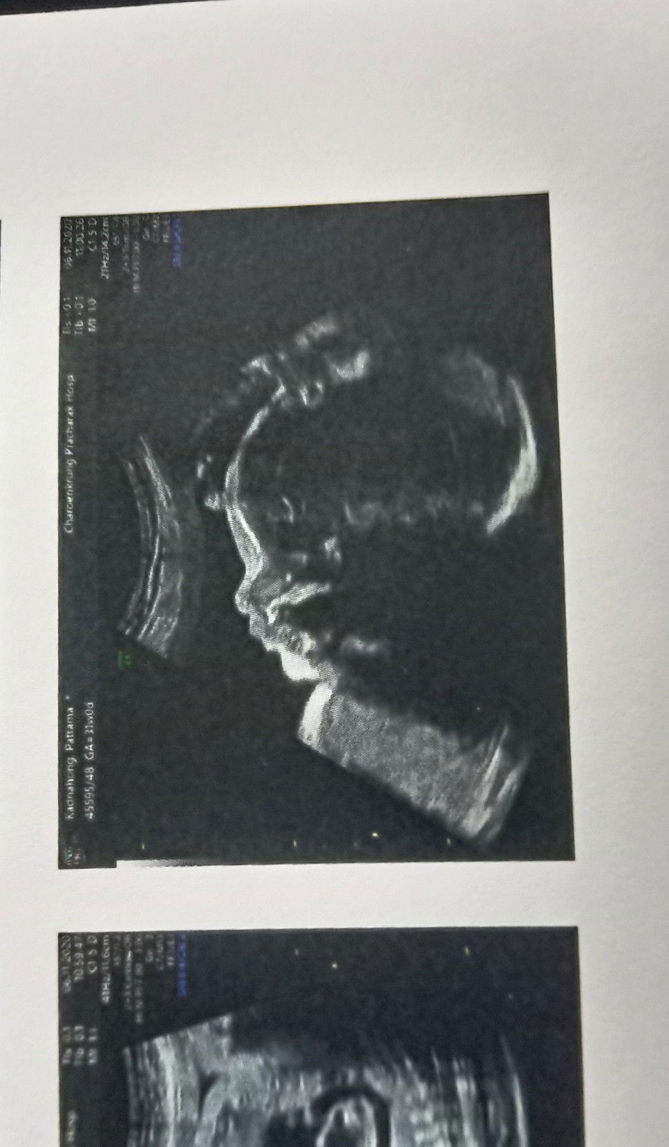 Pattama Kadnahong profile icon