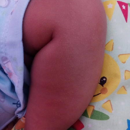 bintik putih