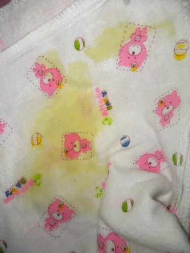 กังวลค่ะ#ท้องแรก