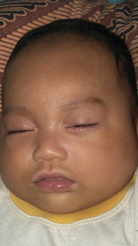 Mulut Belang