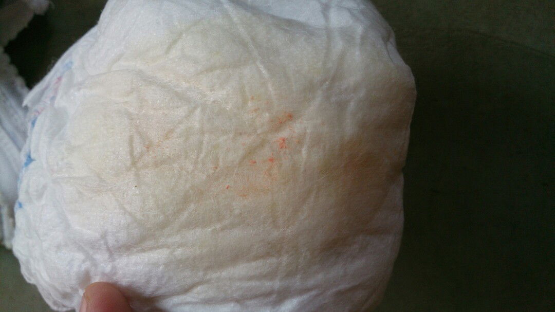 ANAKKU KENAPA???!! ???