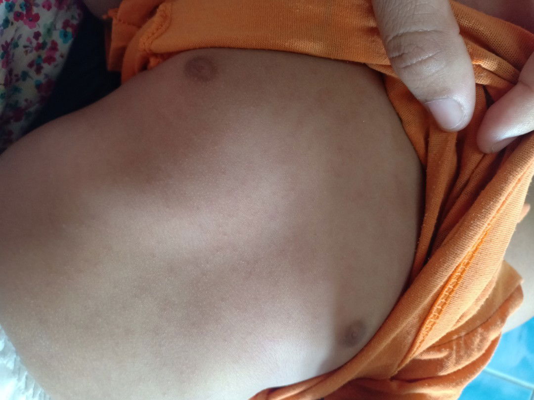 น้องออกหัดหรือป่าวค่ะ