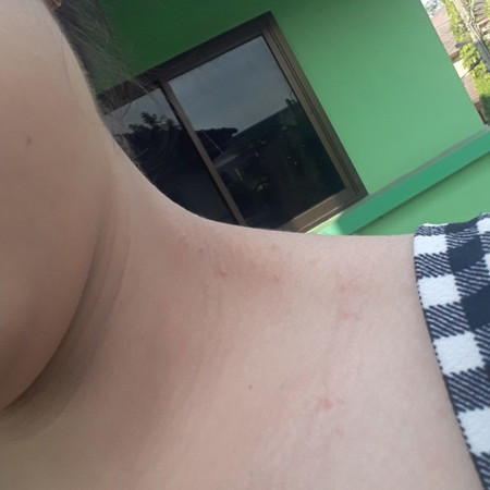 แม่ๆบ้านไหนมีเม็ดๆขึ้นแบบนี้บ้างค่ะ