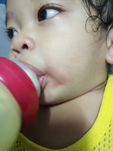 มีลูกๆบ้านไหนเป็นเหมือนกันไหมคะ