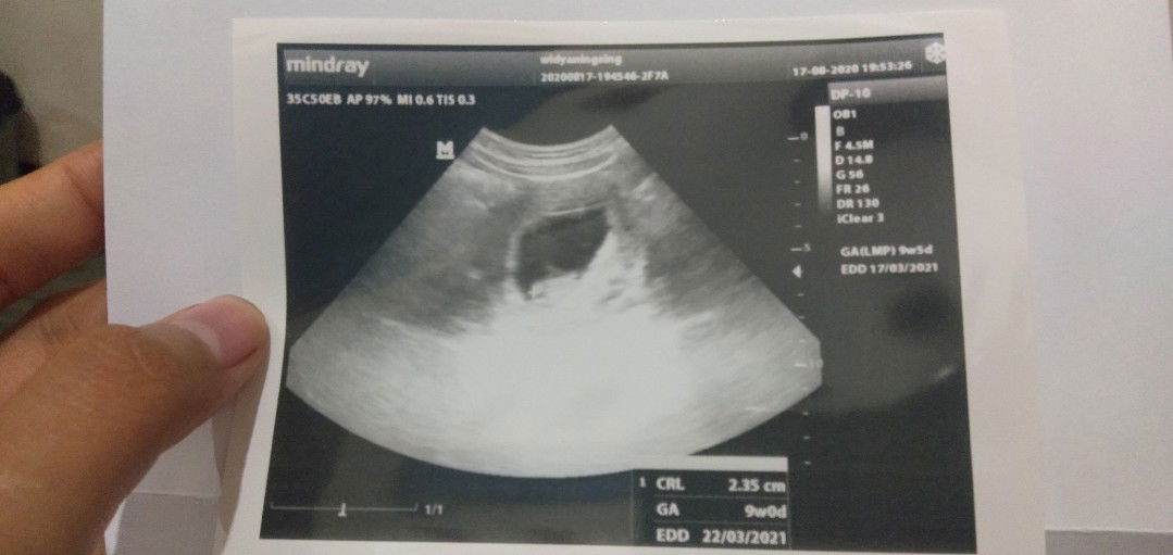 Widyaningsih profile icon