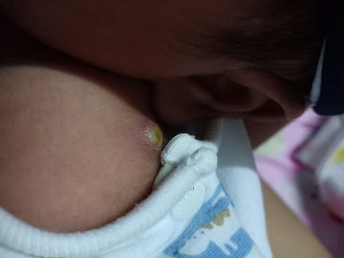 ลูก1เดือนกับอีก1วัน