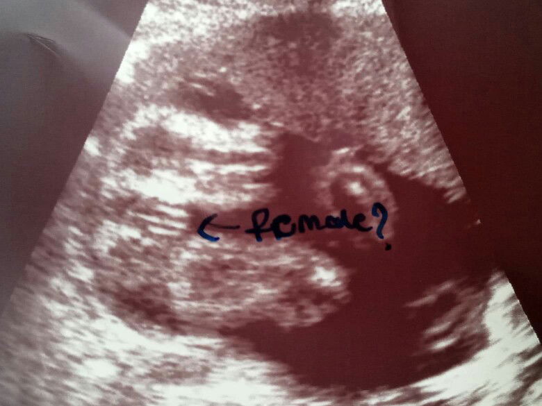 เเม่พิมพ์ profile icon